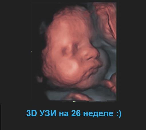 3D УЗИ плода на 26 неделе беременности